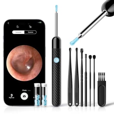 Otoscope Oreille 1080P HD Camera Oreille Nettoyage avec 6 LED Lumières - Équipé de 7 Cure-Oreilles Traditionnels - Nettoyeur Oreille Compatible iOS & Android (Noir Brillant)