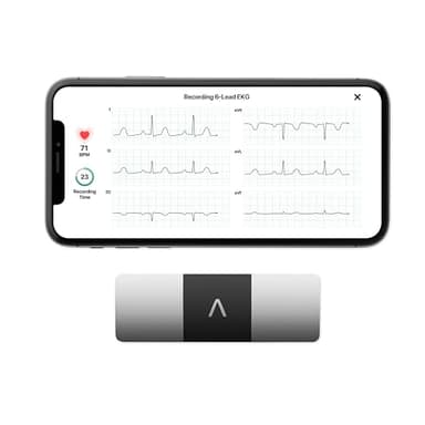 AliveCor KardiaMobile 6L | Le Moniteur ECG Personnel connecté à 6 dérivations. Détectez la Fibrillation auriculaire en Seulement 30 Secondes - à Tout Moment, n'importe où.