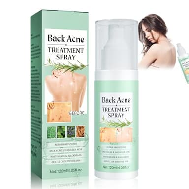 Acné Dos, Traitement de l'acné Corporelle, Spray de Traitement de l'acné pour le Dos, Spray Nettoyant pour l'acné du dos, Nettoyage en Profondeur de l'acné du Corps, Votre Peau Plus Lisse, 120ml
