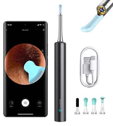BEBIRD Otoscope