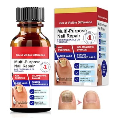 30ml Professionnel Soin D’ongle Vernis, Réduit Les Ongles Décolorés Épaissis,Renforce l'Ongle Favorise La Repousse D'ongles,Pour Des Ongles Fragiles Sains & Beaux