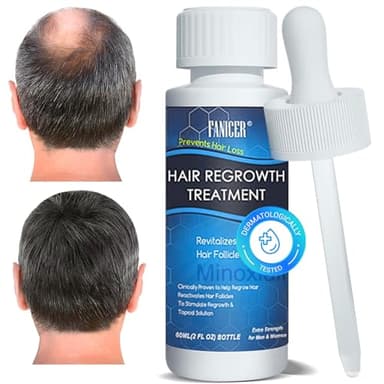 60ml Sérum Anti Chute Cheveux,Stimule la Pousse et Réduit la Chute, Formule Légère pour Cheveux Plus Épais et Résistants, pour Hommes et Femmes